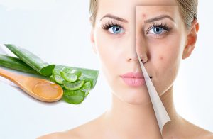 Điều Trị Mụn Ẩn Dưới Quai Hàm Đúng Chuẩn Giúp Bạn Tự Tin Hơn Sau 7 Ngày